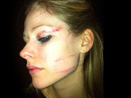 avril lavigne beat up. Avril Lavigne got into a fight early Monday morning at the Roosevelt Hotel 